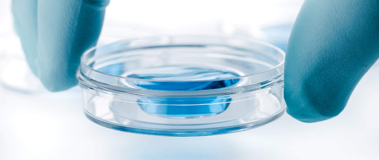 IN VITRO DIAGNOSTICS