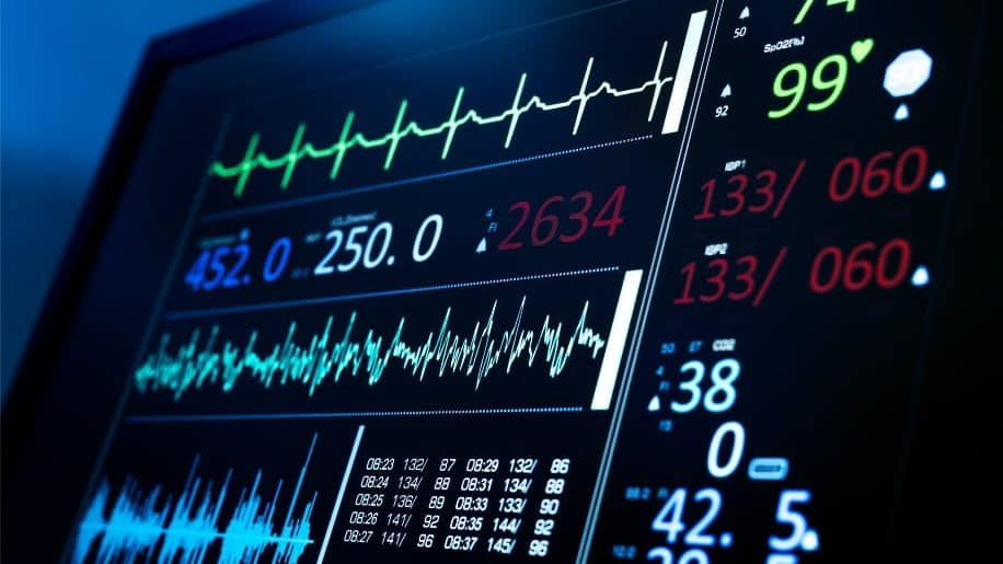 Quality Management Systems ECG hospital monitor showing vital statistics