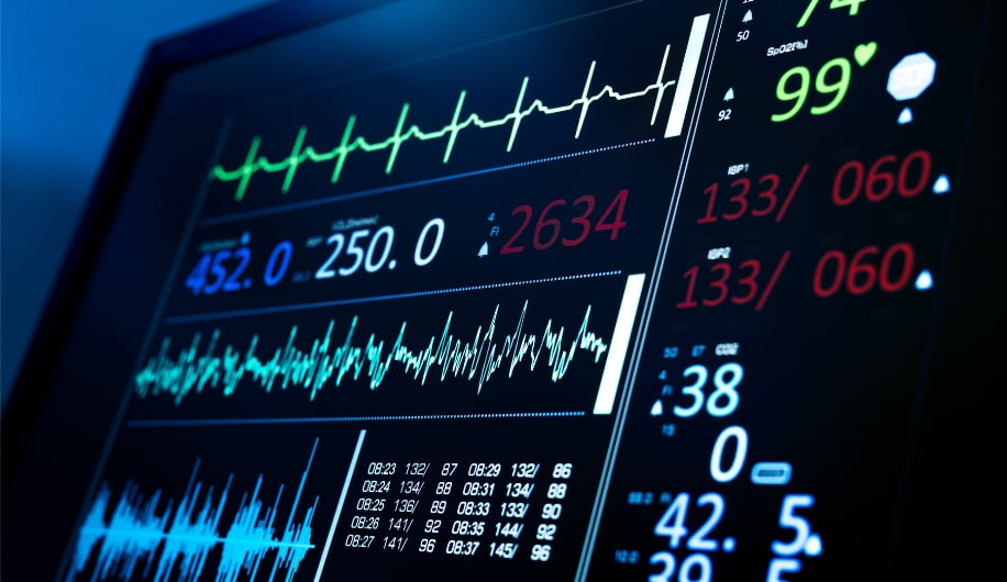 Quality Management Systems ECG hospital monitor showing vital statistics